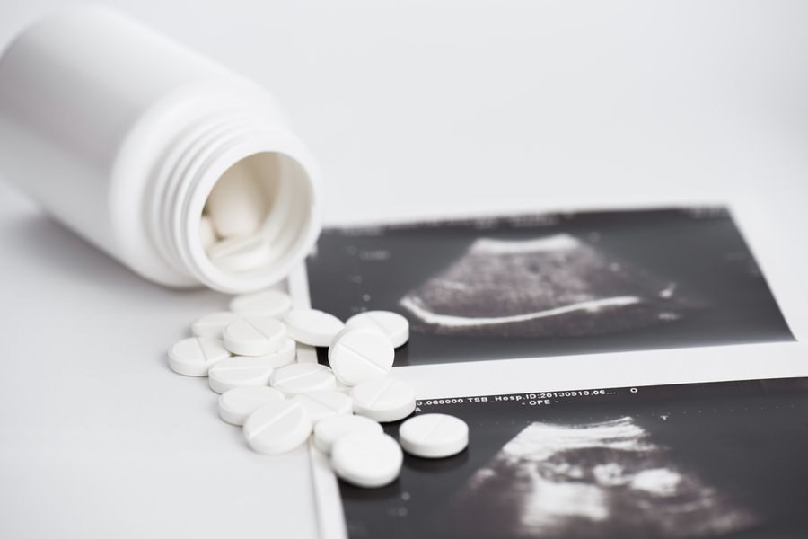 Sud Sjeverne Karoline ukida ograničenja kemijskih pobačaja kod kuće